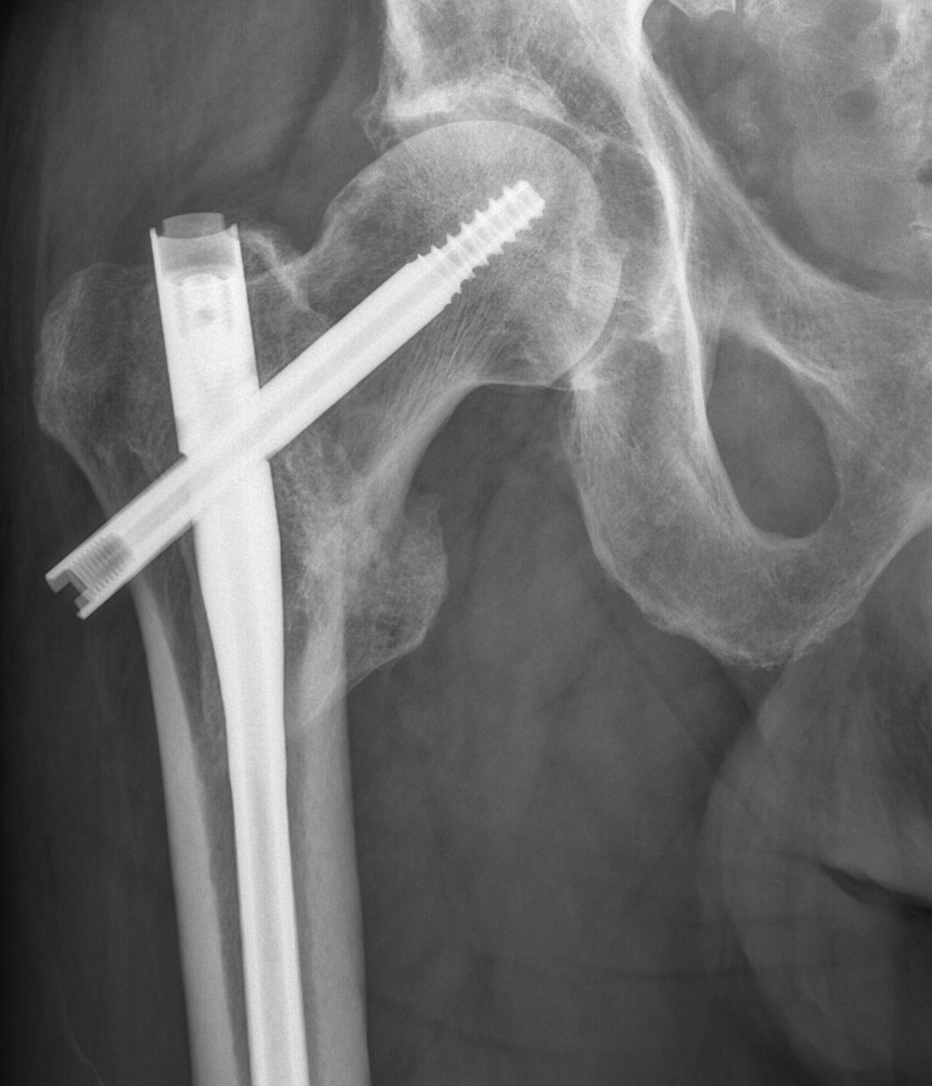 pin xray